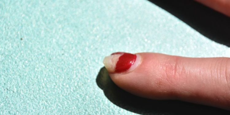 Zwolnienie lekarskie L4 na zerwany paznokieć