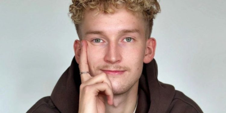 Na zdjęciu znajduje się kaluch, który podpiera ręką podbródek