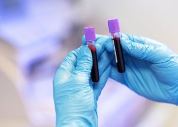 Jak czytać wyniki morfologii? Co oznaczają skróty: RBC, WBC, HGB i inne?